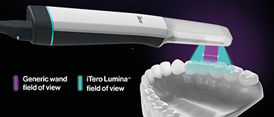 iTero Lumina Pro（口腔内スキャナー）｜お見積り・導入に関するご相談