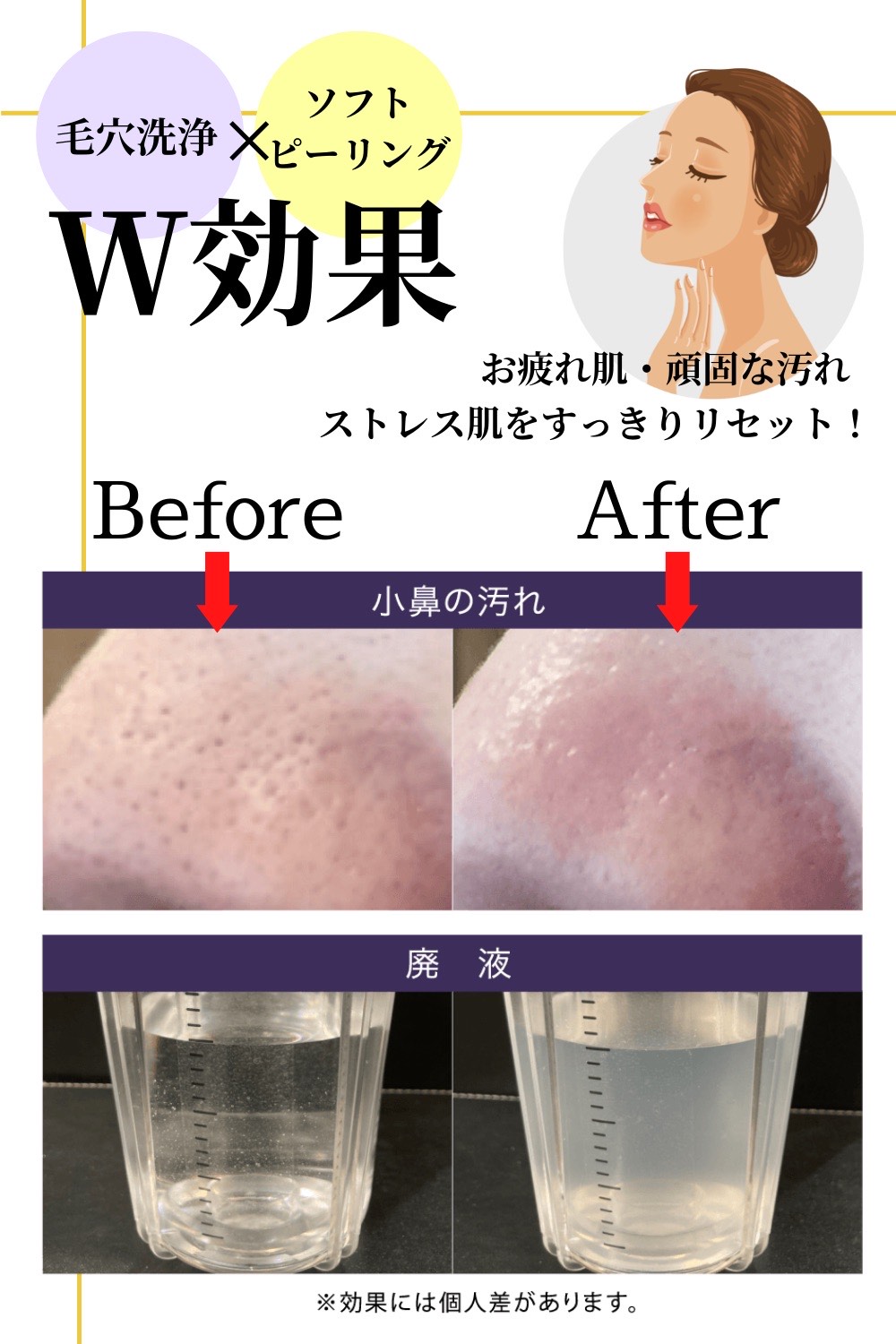 アクアフェイシャル – 西三河の皮膚科・美容皮膚科｜あおい皮フ科