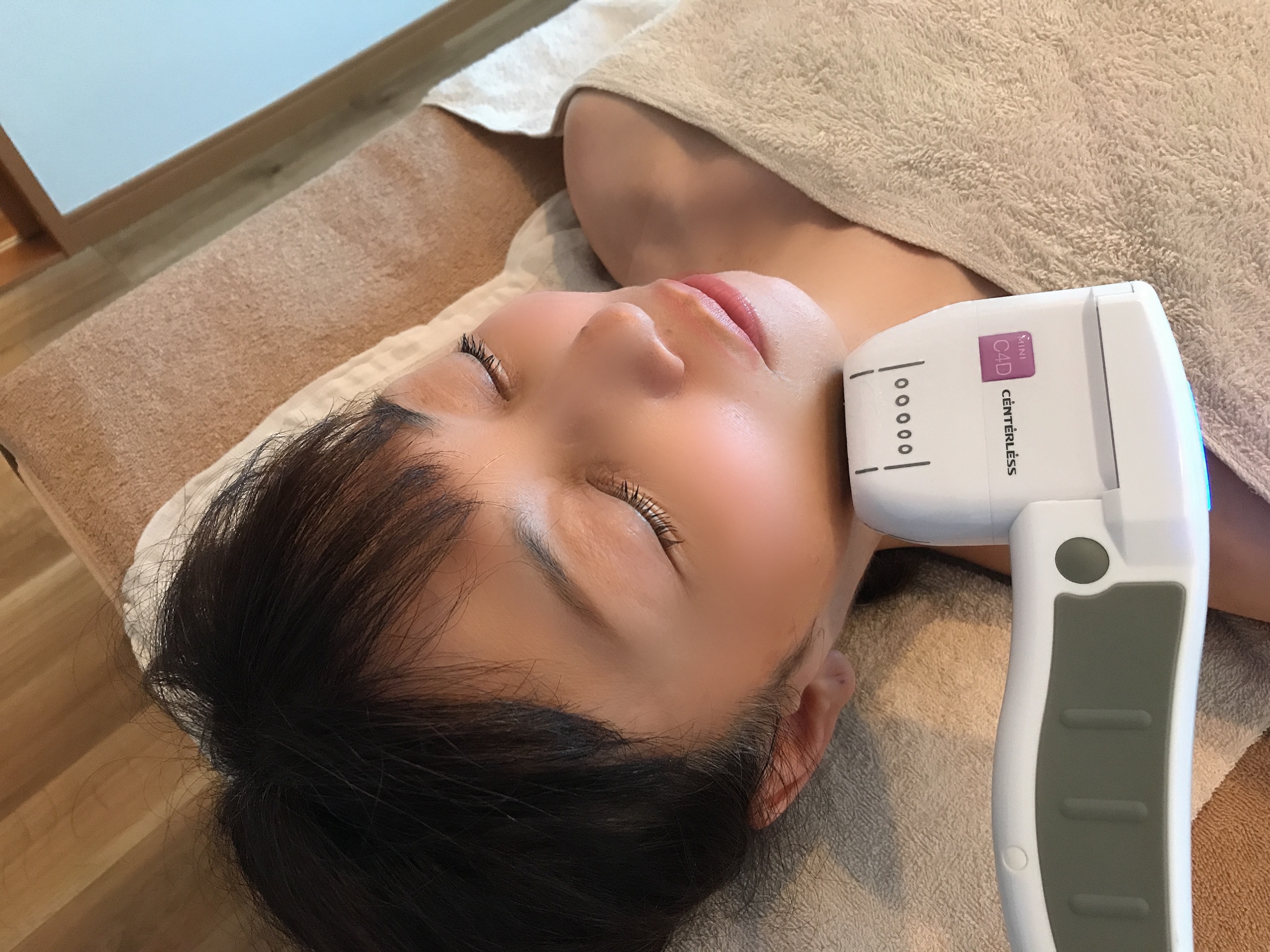 小顔リフトアップ【ハイフ】 | エンジェルエッグ