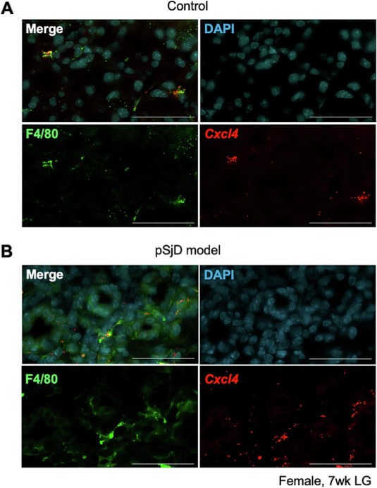 Differential chemokine profiles between lacrimal and salivary