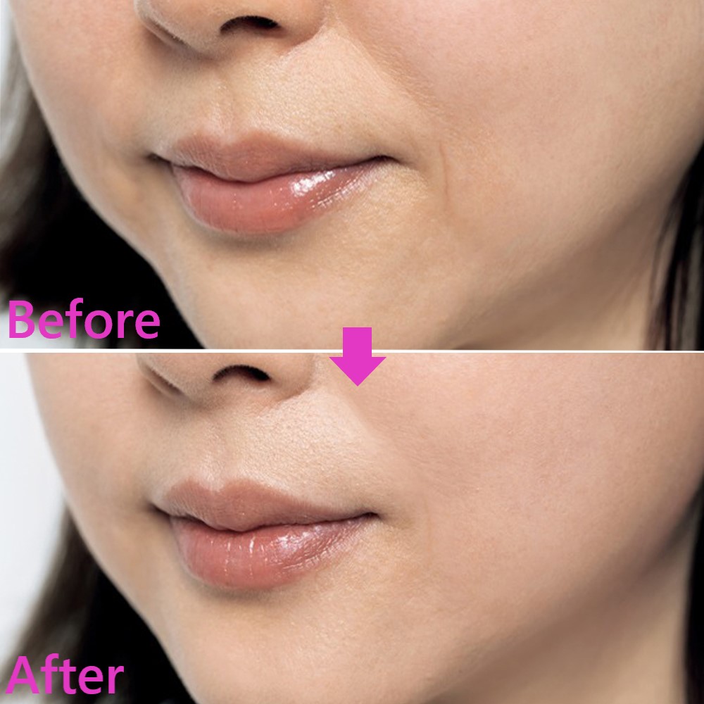 即効でできる方法だけ！【ほうれい線】の消し方5つ | 美ST ONLINE