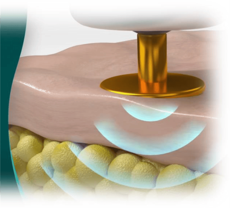 音波振動機器 DR SPA PRO | ビューティー企画インターナショナル株式