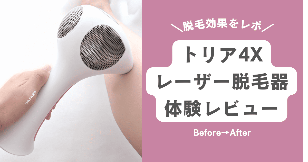 効果は？レーザー脱毛器トリア4Xで足脱毛してみた結果【体験談】口コミ