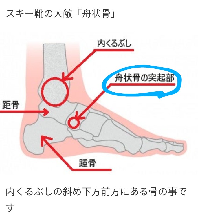 スキーブーツのシェル出し。｜てっちん@のブログ｜15の汁 - みんカラ