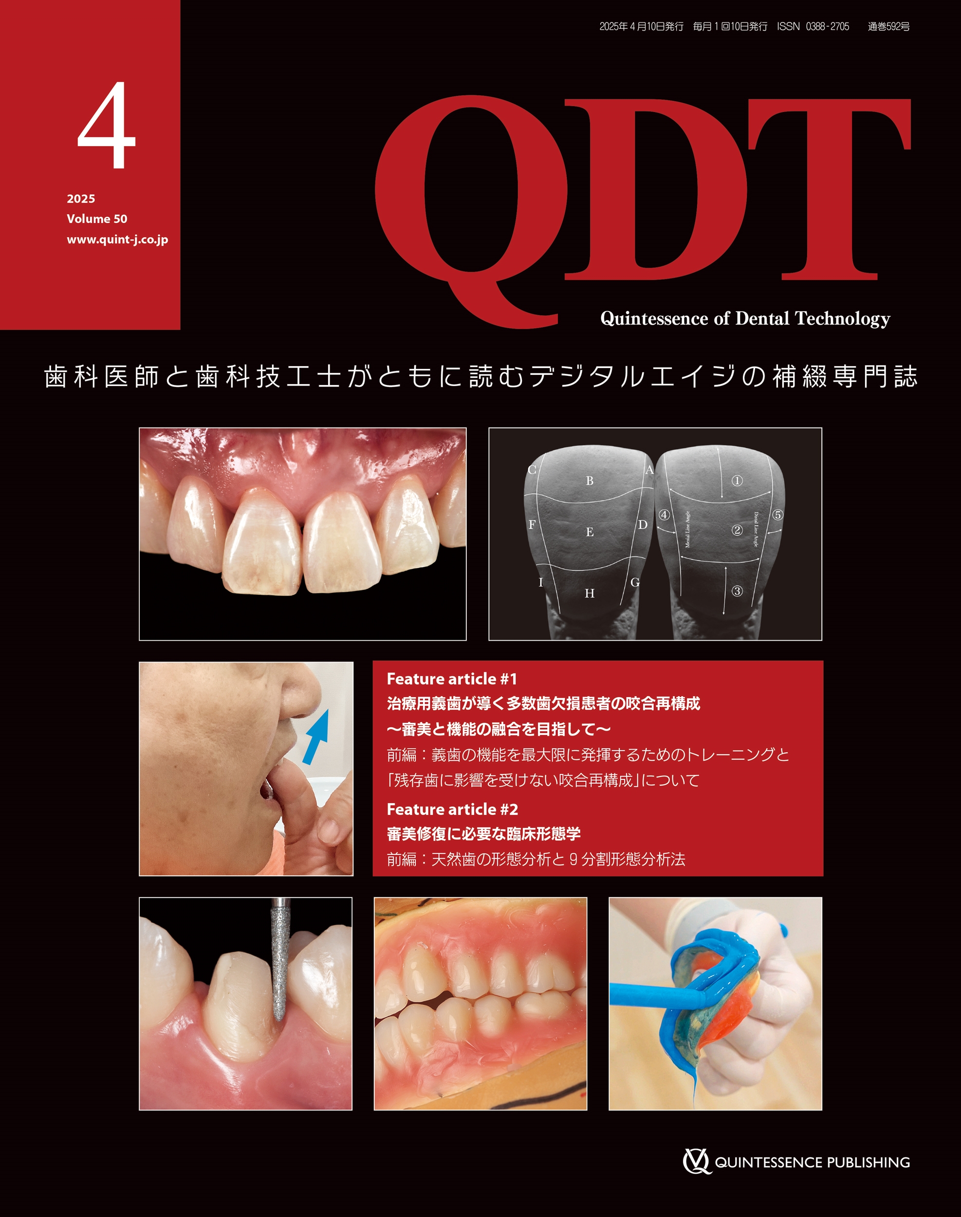 dショッピング |クインテッセンス出版 「QDT 2025年4月号 歯科医師と