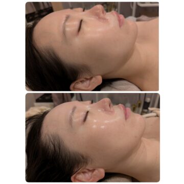 大阪】Cell Novaの小顔痩身エステ｜小顔リフトアップ・フェイシャル