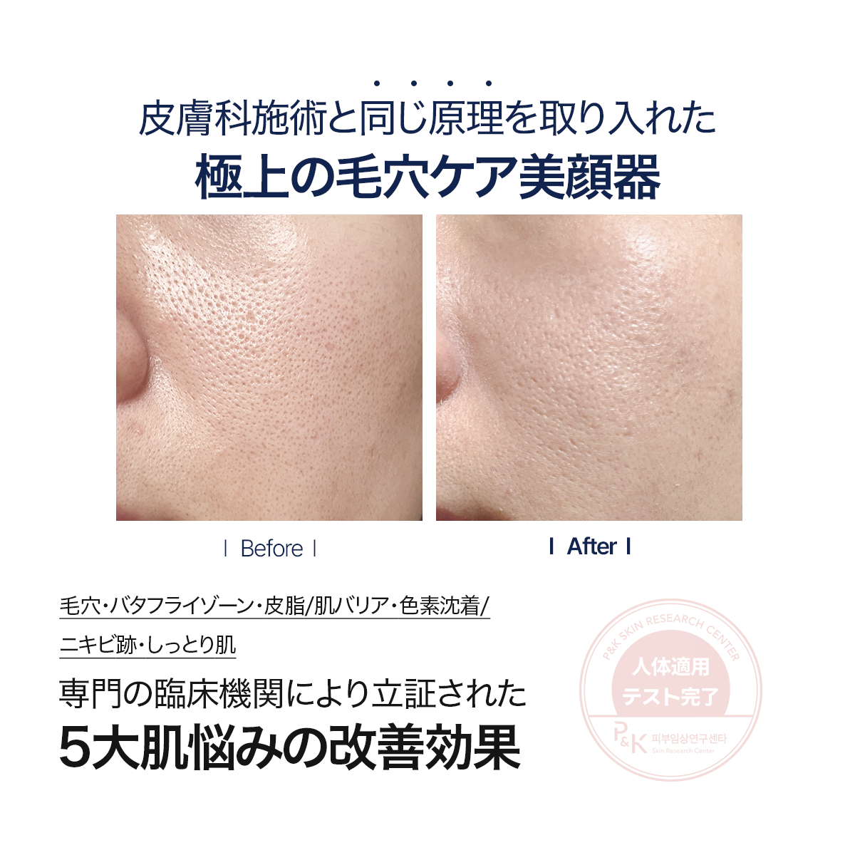 公式】 ペンタショット – CELORA.BY JP