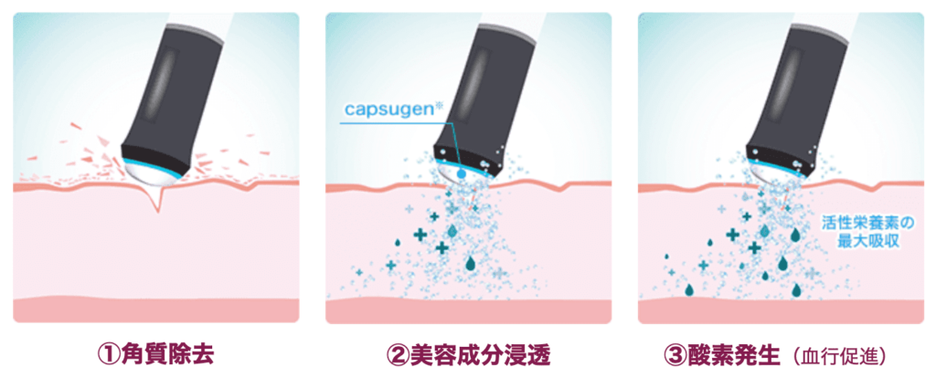 経験者レビュー】品川美容外科のオキシジェネオの口コミ・評判まとめ