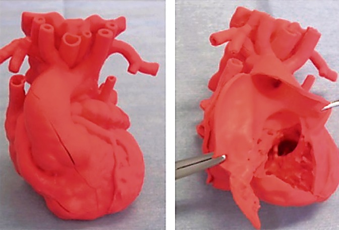 国循、超軟質実物大3D心臓モデルをクロスエフェクトの医工連携で開発