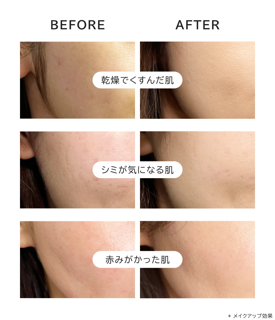 WrinkFade（リンクフェード）/公式サイト