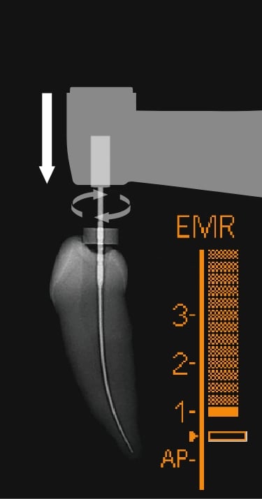 トライオートZX2+（plus）｜オンラインカタログ internet DO【株式会社