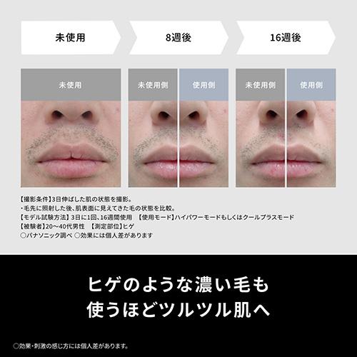 長期5年保証付】パナソニック(Panasonic) ES-WG0B-H 光美容器 スムース