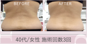 業務用痩身複合機マジックポットの特徴・効果・価格まとめ - 【公式