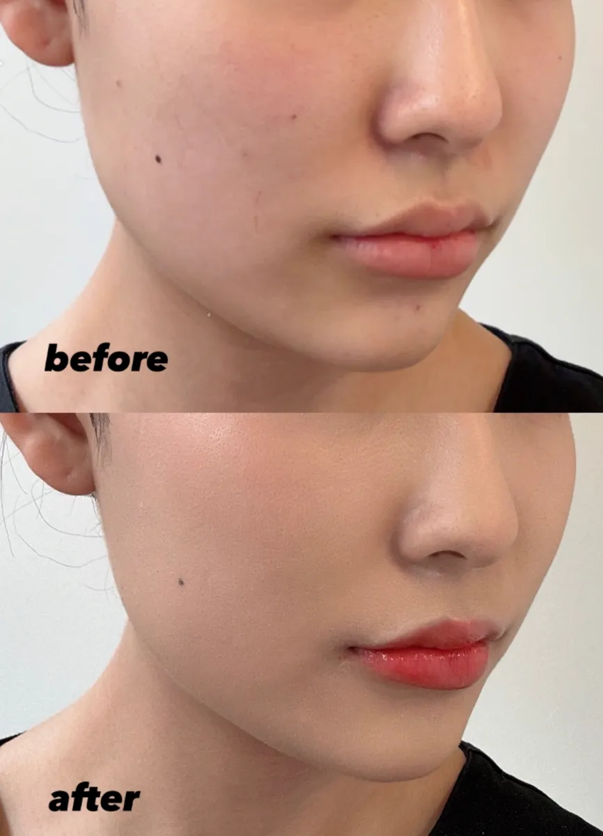 ジェーンアイルデール スキントゥイションSPF30 | スタッフブログ