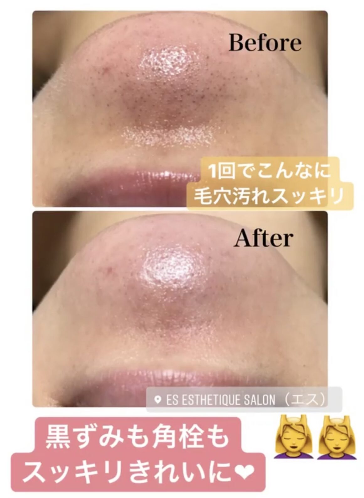 ハイドロスキン – ES esthetique salon