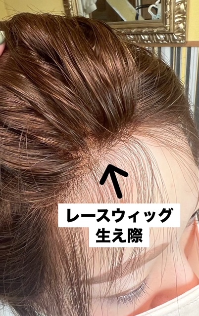 いやしのウィッグ evergreen / あるさんウィッグ®レース総手植え