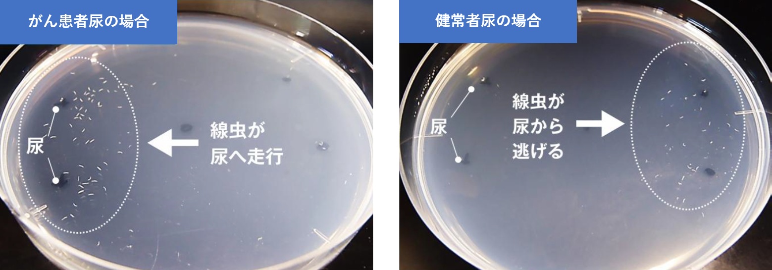 線虫がん検査 N-NOSE（エヌノーズ） | 福岡青洲会病院 | 地域医療支援