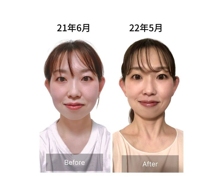 NEWAリフト ニューワリフト NEWAリフト(ニューワリフト) | セイコ