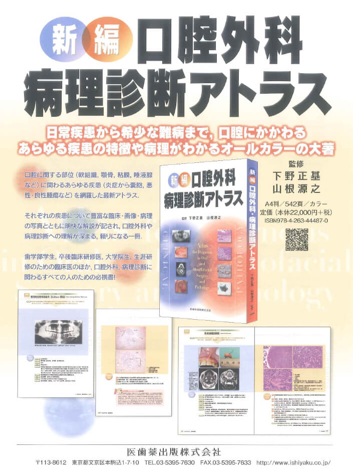 書籍詳細「新編 口腔外科病理診断アトラス」 | フォルディネット
