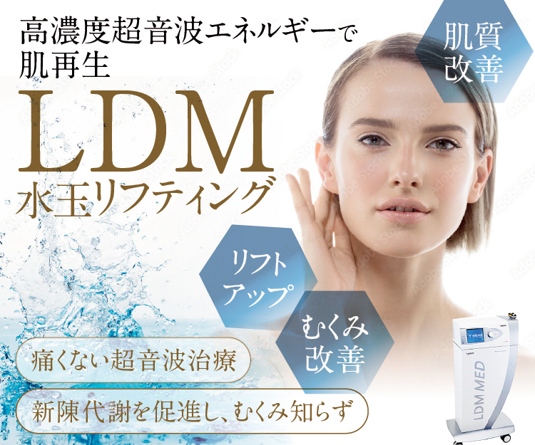 水玉リフティングLDM｜ニキビ痕、肌質改善｜神戸 三宮