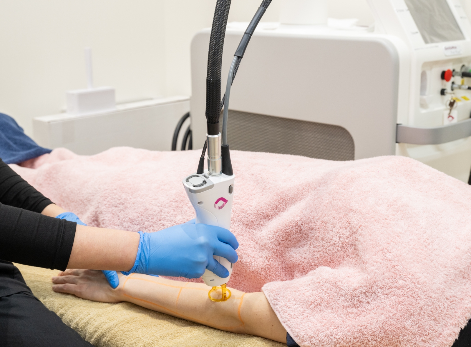 医療レーザー脱毛のご相談は岐阜県土岐市の内科・小児科「ひだまり