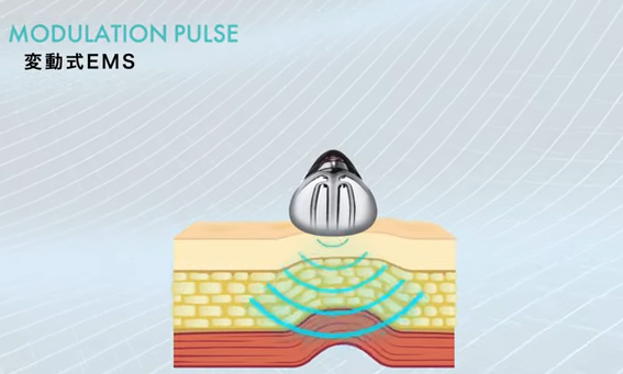 美顔器パイラナイトは効果なし？機能やリアルな口コミをご紹介 | 家庭