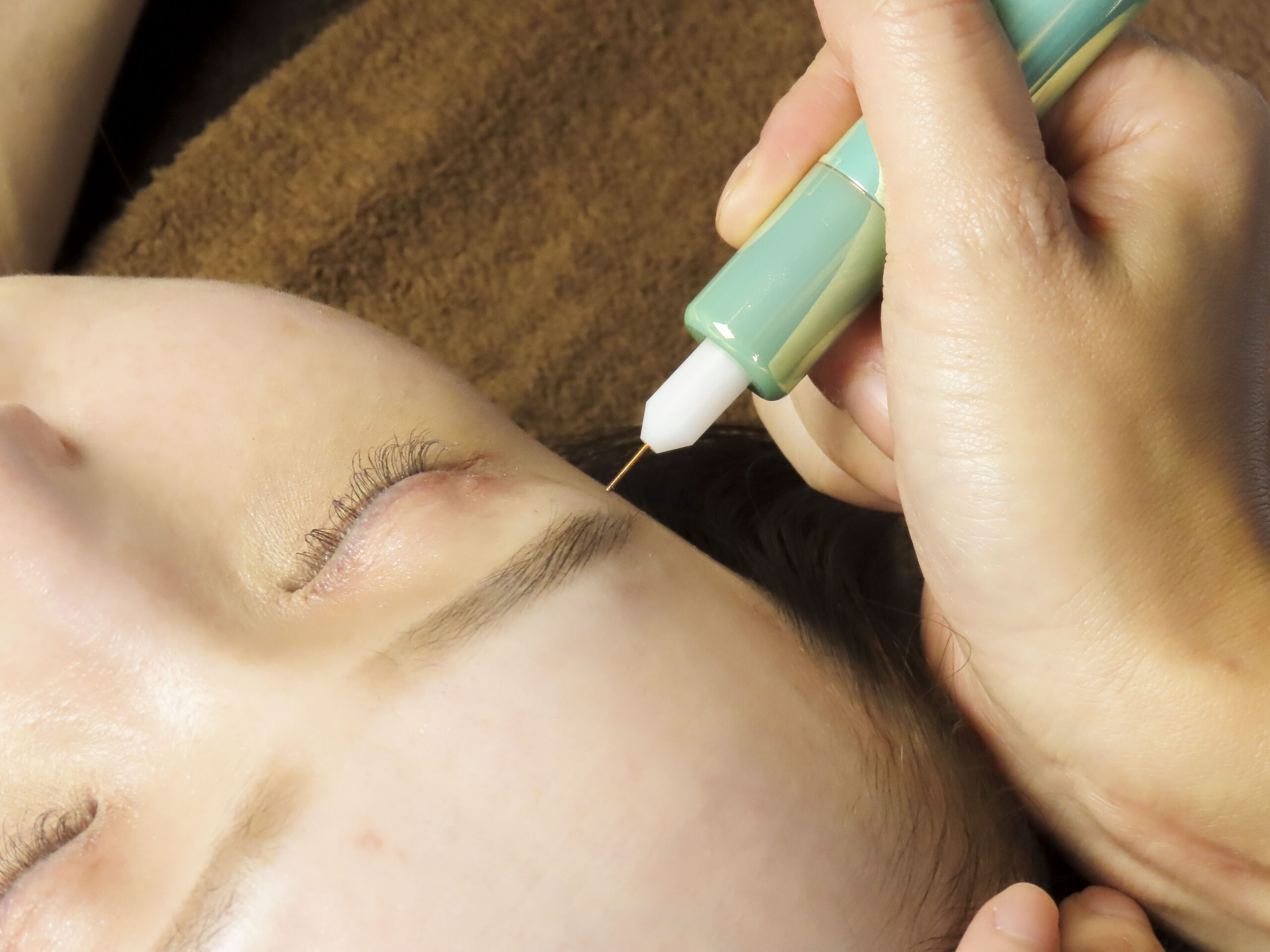 シミケアについて - hitohada beauty salon【シミ・たるみ・毛穴改善