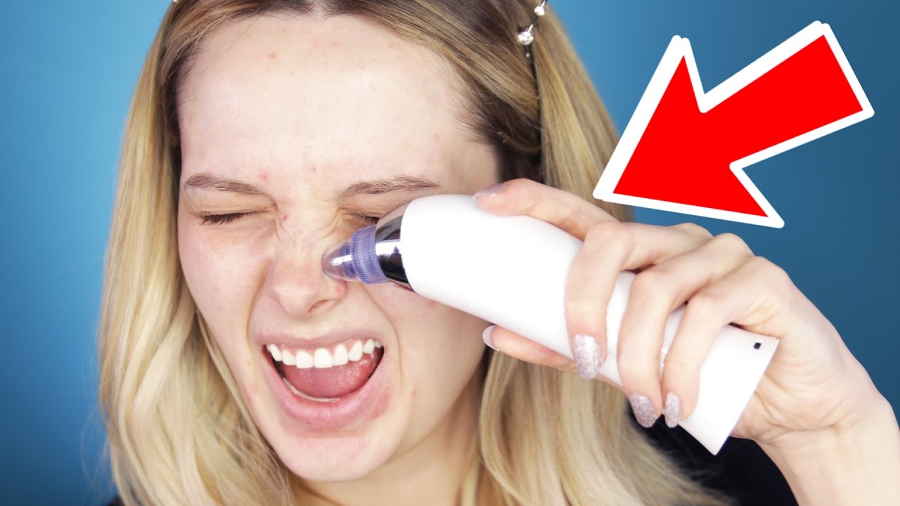 TESTING A BLACKHEAD VACUUM SUCTION MACHINE! // MyPaleSkin - YouTube