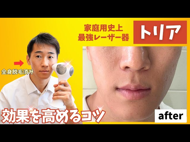 How to use the Tria home laser hair removal device and tips