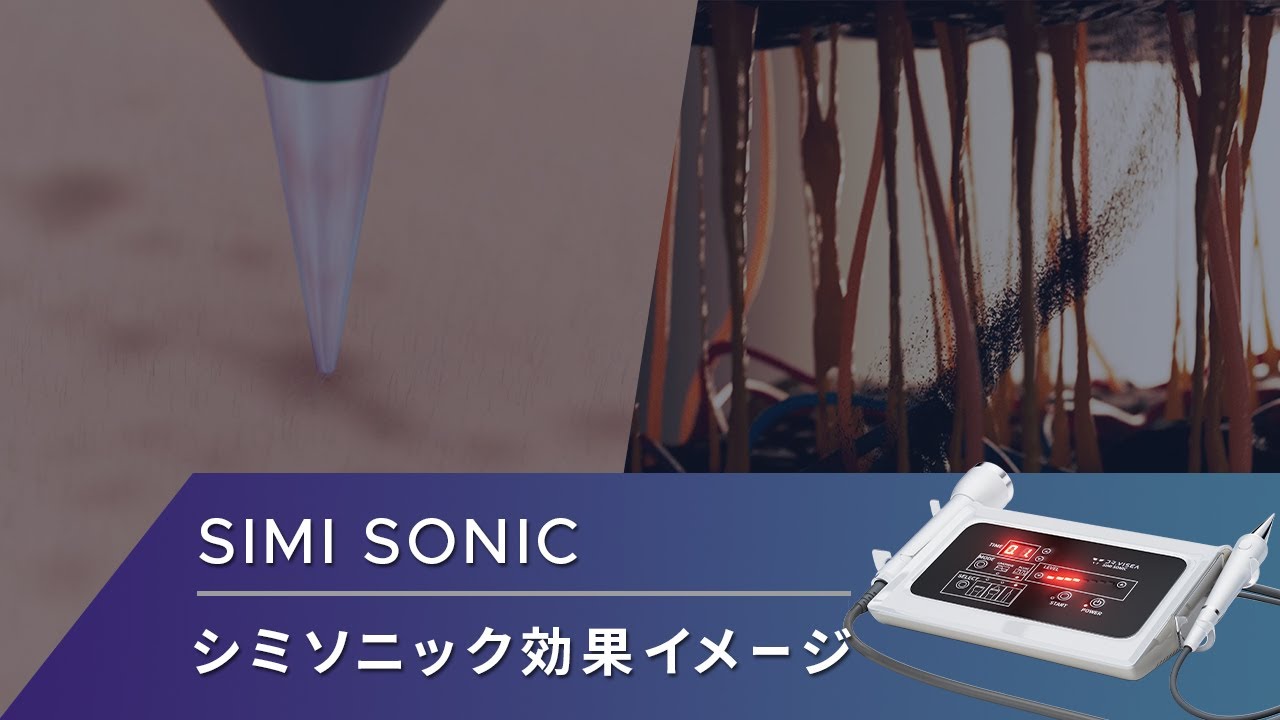 業務用シミ取り】シミクライオポレーション｜特徴やマシン価格