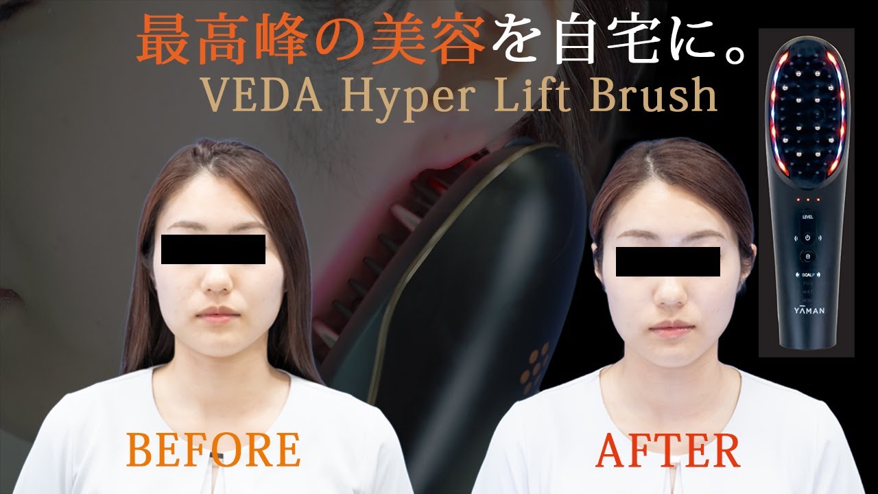 自宅で本格リフトアップ！YAMANのブラシ型美顔器ヴェーダハイパー