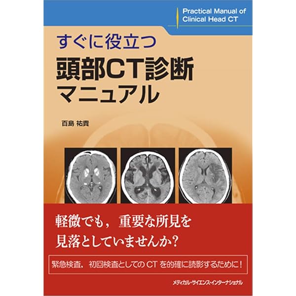 頭部画像解剖 徹頭徹尾―疾患を見極め的確に診断する | 蓮尾 金博 |本