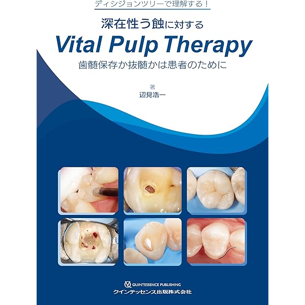 Amazon.co.jp: スリーステップ秋山メソッドBASIC : 秋山勝彦: 本