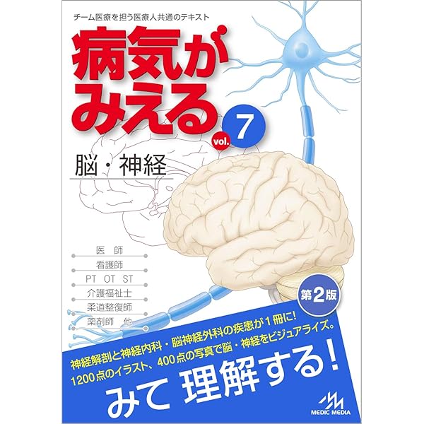 病気がみえる vol.4 呼吸器 | 医療情報科学研究所 |本 | 通販 | Amazon