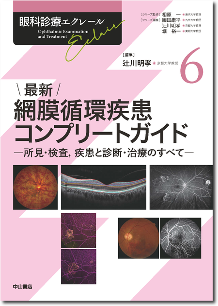 m3電子書籍 | ④最新 弱視・斜視診療エキスパートガイド―解剖生理