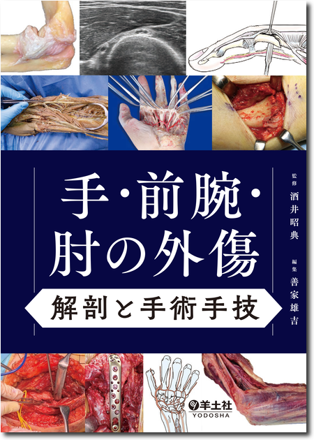 m3電子書籍 | 体験する手外科 第2巻～変性疾患・腫瘍編