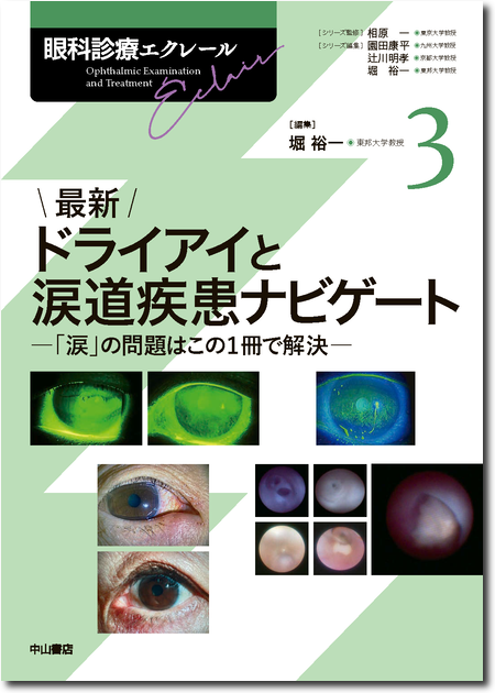 m3電子書籍 | ④最新 弱視・斜視診療エキスパートガイド―解剖生理