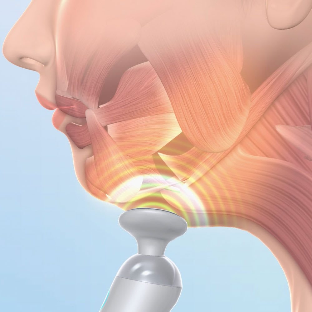 dショッピング |スタイリーフェイス 美顔器 EMS あご フェイスライン