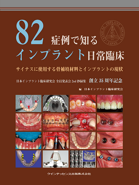 82症例で知るインプラント日常臨床 - クインテッセンス出版