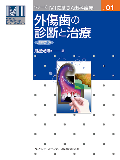 治癒の歯内療法 新版 - クインテッセンス出版