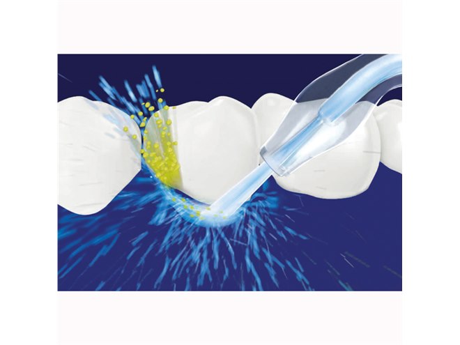 パナソニック、舌磨きノズル付属の「ジェットウォッシャー ドルツ EW