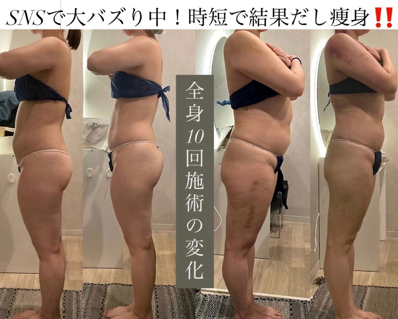 痩身革命 大宮店｜ホットペッパービューティー