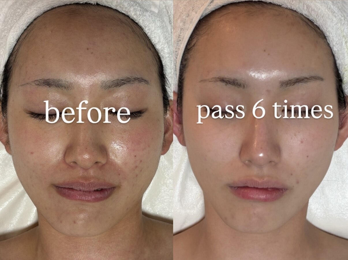 フォー(For)｜ホットペッパービューティー