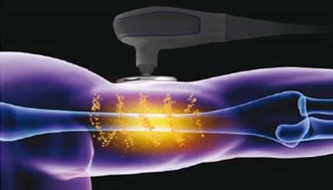 WHAT's INDIBA® | INDIBA JAPAN - インディバ・ジャパン