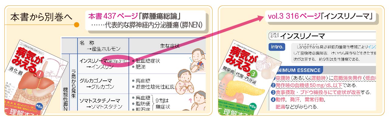 病気がみえる』まとめ買いのすゝめ | INFORMA by メディックメディア