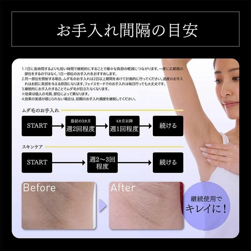 ex-coolflashbeaute 冷却脱毛器 クールフラッシュボーテ : サカイ卸売