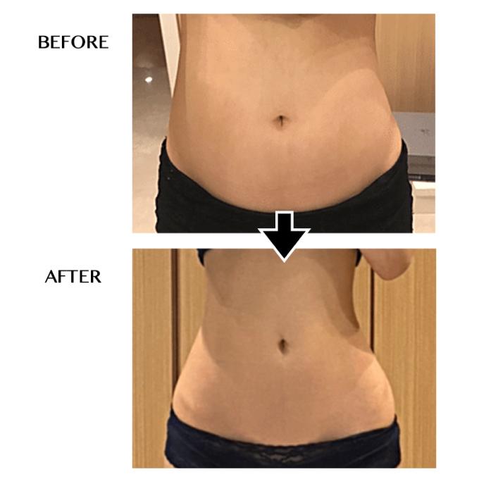 セルゼロ CELLZERO セルゼロバック BAG 美顔器・スチーマー 【メーカー