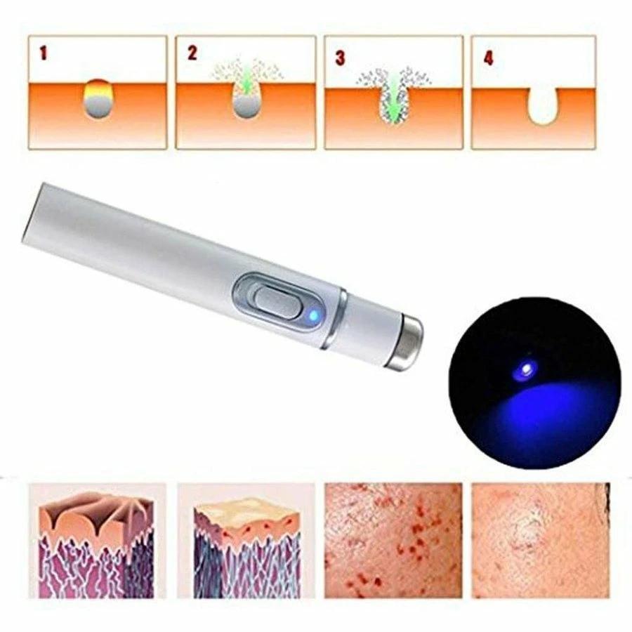 LED美顔器 にきび レーザー ペン ポータブル 青色 光療法 ソフト 抗