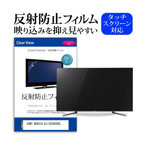 casemania55_mat-tv-k0001152457