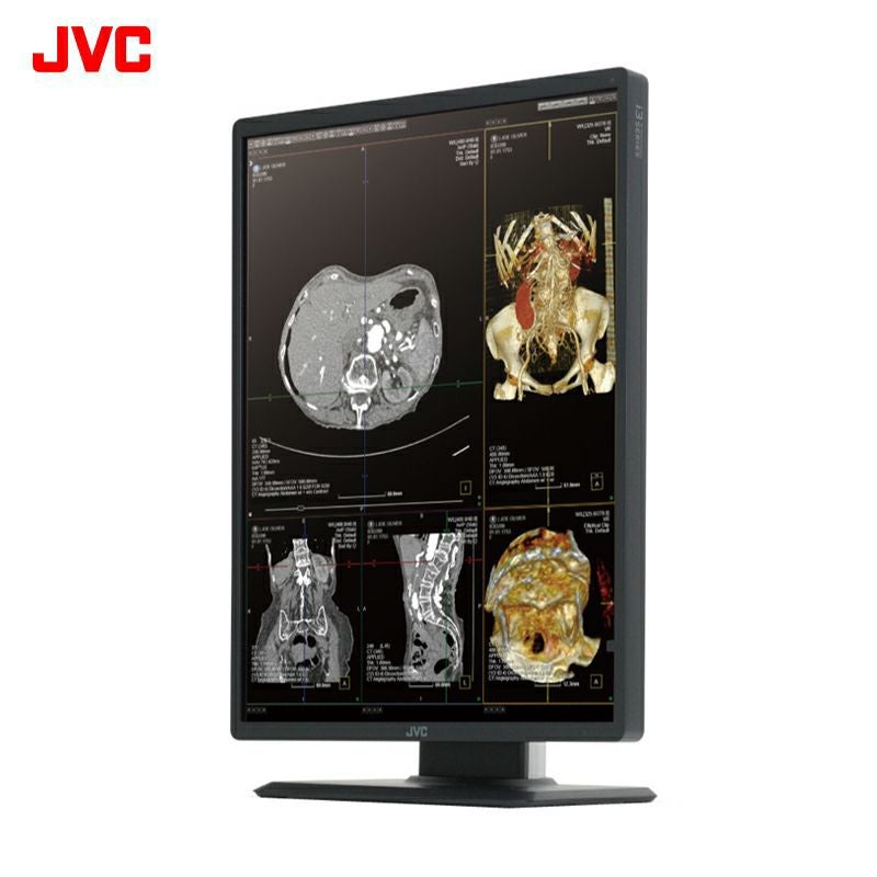 300万画素21.3型カラー液晶モニター Type-C接続・JESRA X-0093(管理